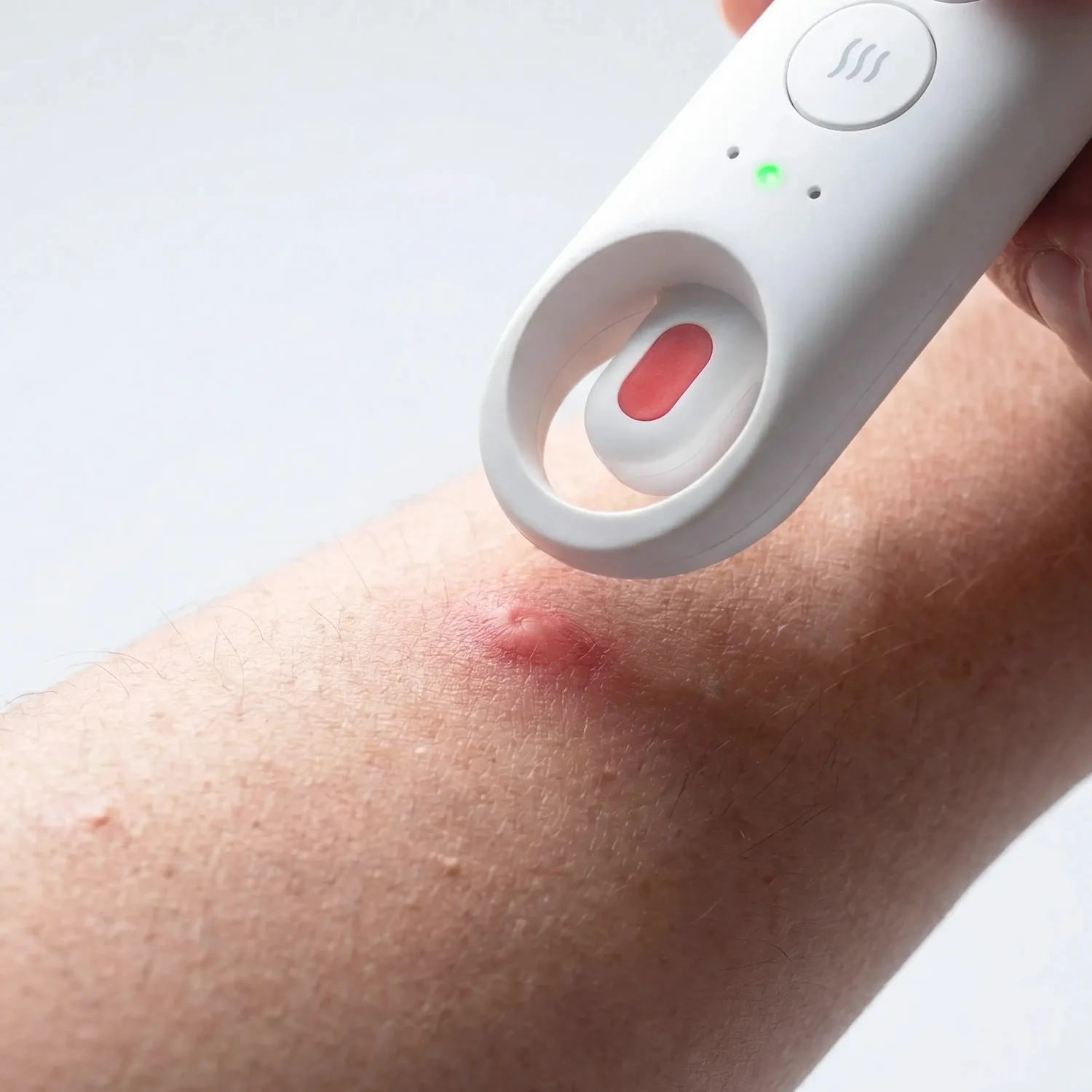iHealth D-Itch Stick bettpenna mot insektsbett